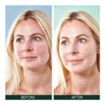 SORTED SKIN  5 in 1  dieninis kremas raustančiai odai SPF50, 30 ml - Image 2