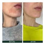 SORTED SKIN intensyvaus poveikio veido losjonas jautriai odai, 50 ml - Image 2