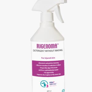 Rigenoma nenuplaunamas